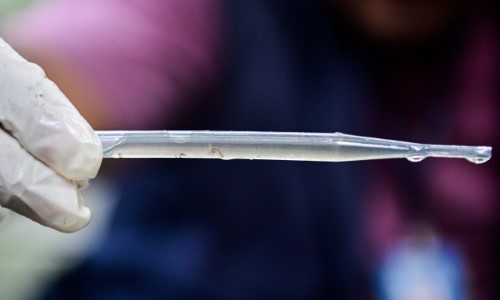 Barra Mansa realiza última medição do LIRAa em 2025 e prepara Dia D contra a dengue